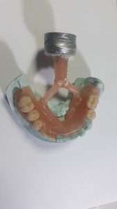 Mecanica Dental
