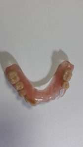 Mecanica Dental